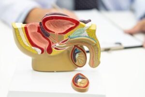La detección temprana puede cambiar el panorama del cáncer de próstata en Colombia